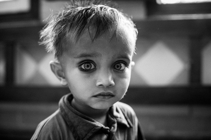 Bilal at a government clinic in Korangi Town