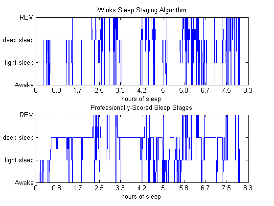 Our algorithm tracks sleep stages the same way a human expert would.