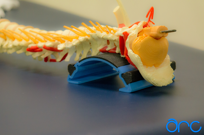 Lying on The ARC for 10-15 minutes places the neck in a neutral curve. The pressure inserts relieve muscle tension.