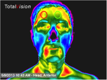 Thermal imaging helps show that your nose doesn't just feel colder. It is.