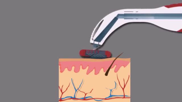 project video thumbnail